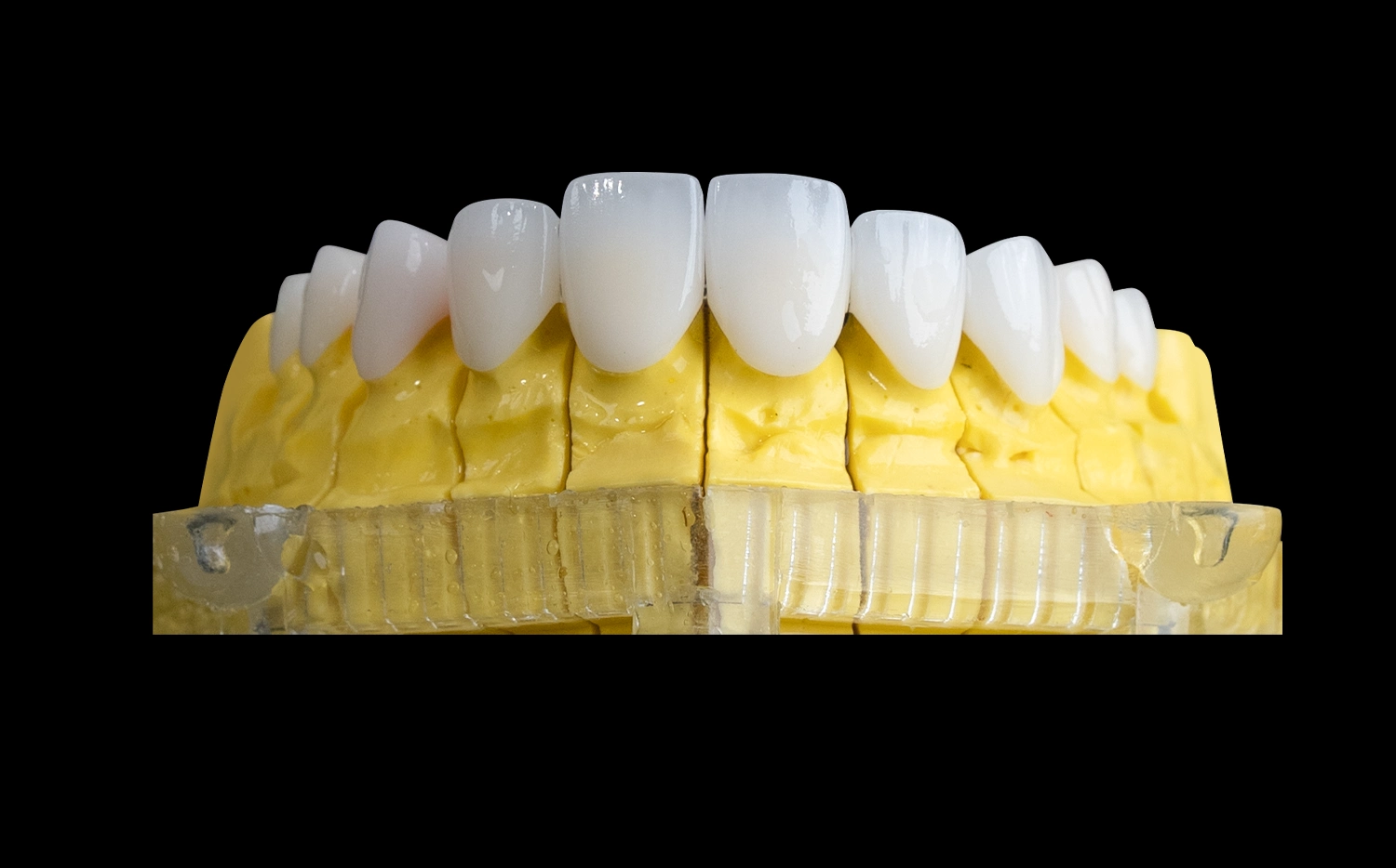 Delia Exclusive Crown Technology