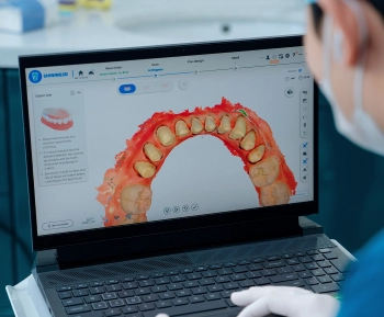 Consultation and Smile Design