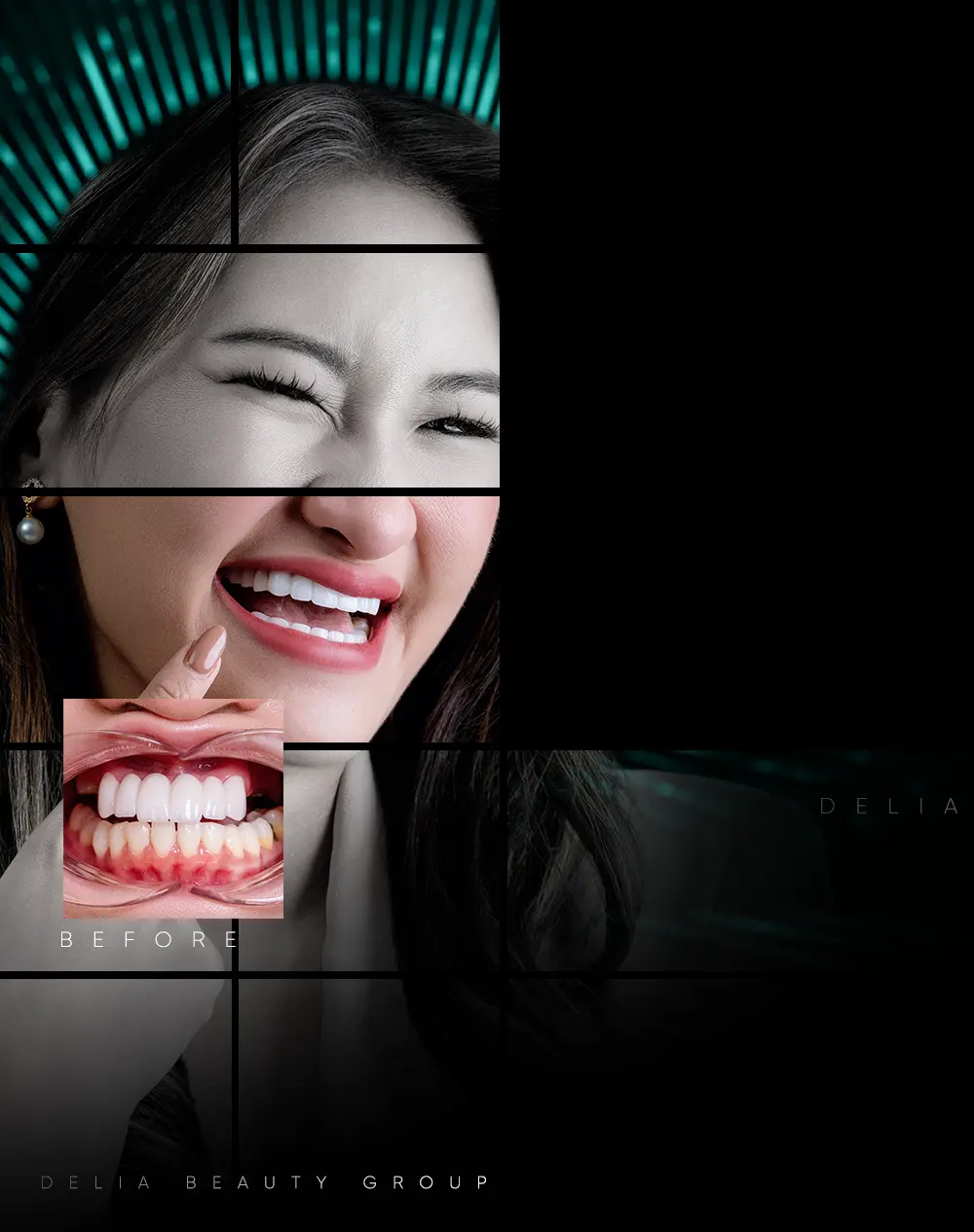 Happy patient with restored smile after Full Arch Implants - Mobile