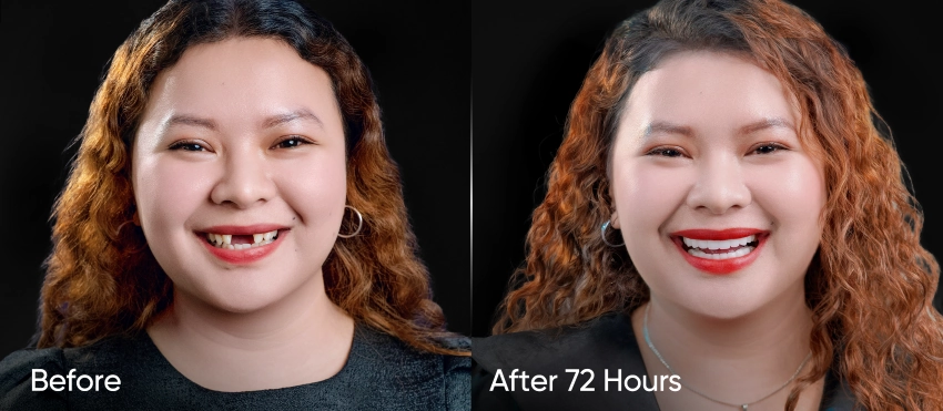 Real Review Facelifting