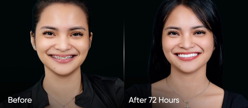 Real Review Breast Augmentation