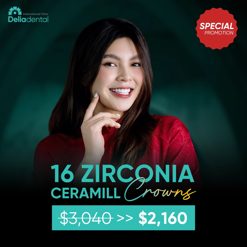 Promotion Spotlight