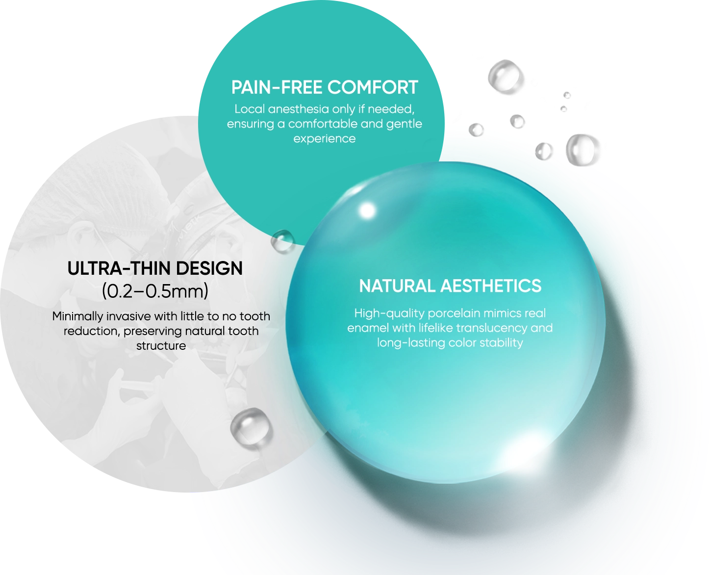 Characteristics of Porcelain Veneers