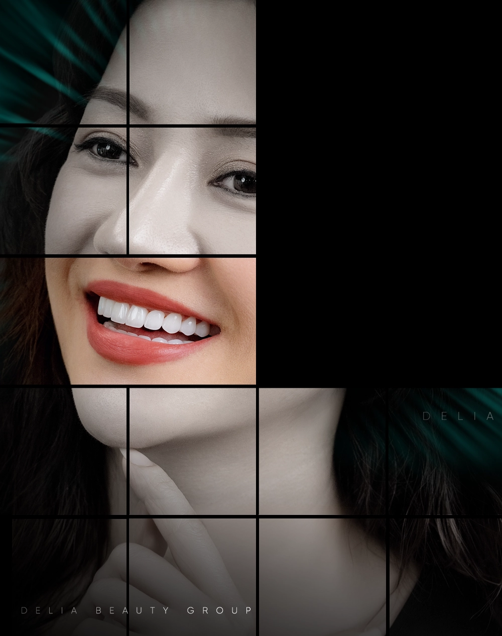 Porcelain Veneers Mobile
