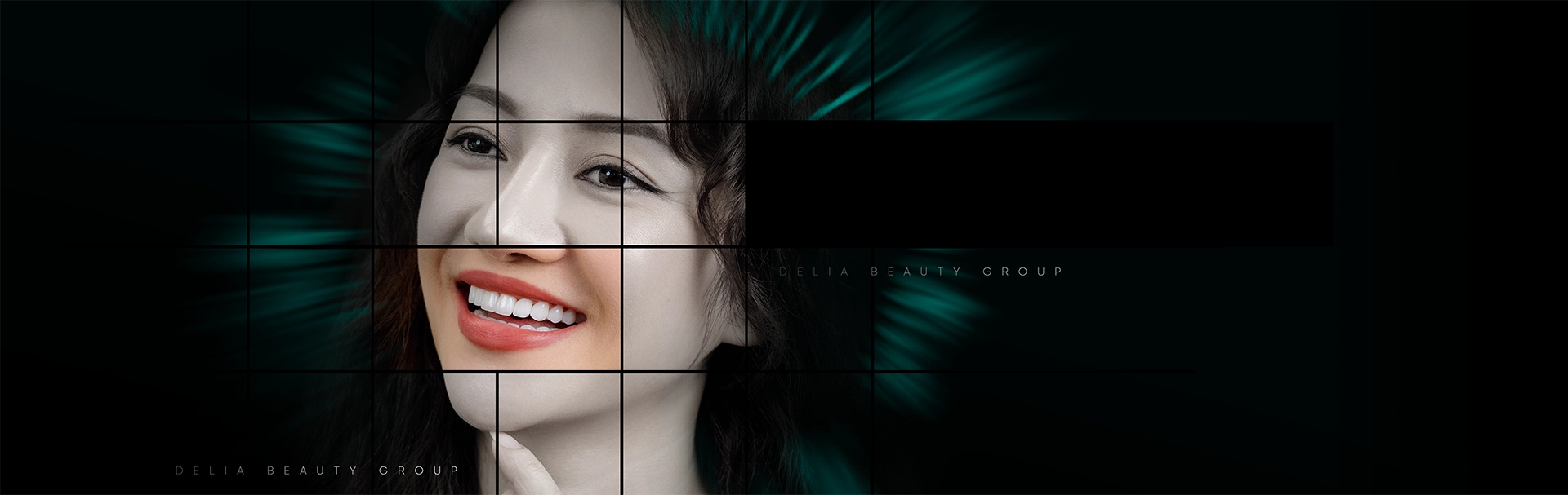 Porcelain Veneers