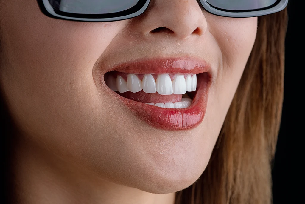 Close up of a natural and seamless smile enhanced by high-quality porcelain crowns