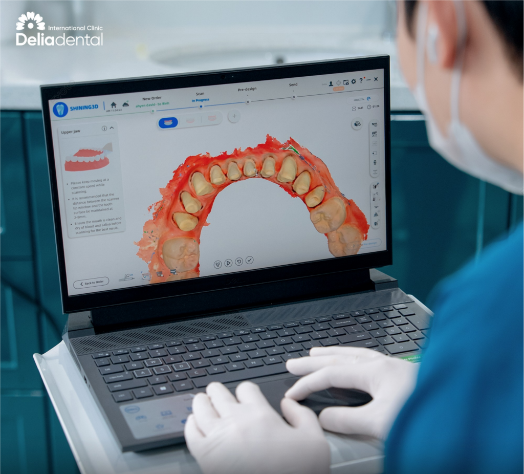 Implants consultation at Delia dental clinic
