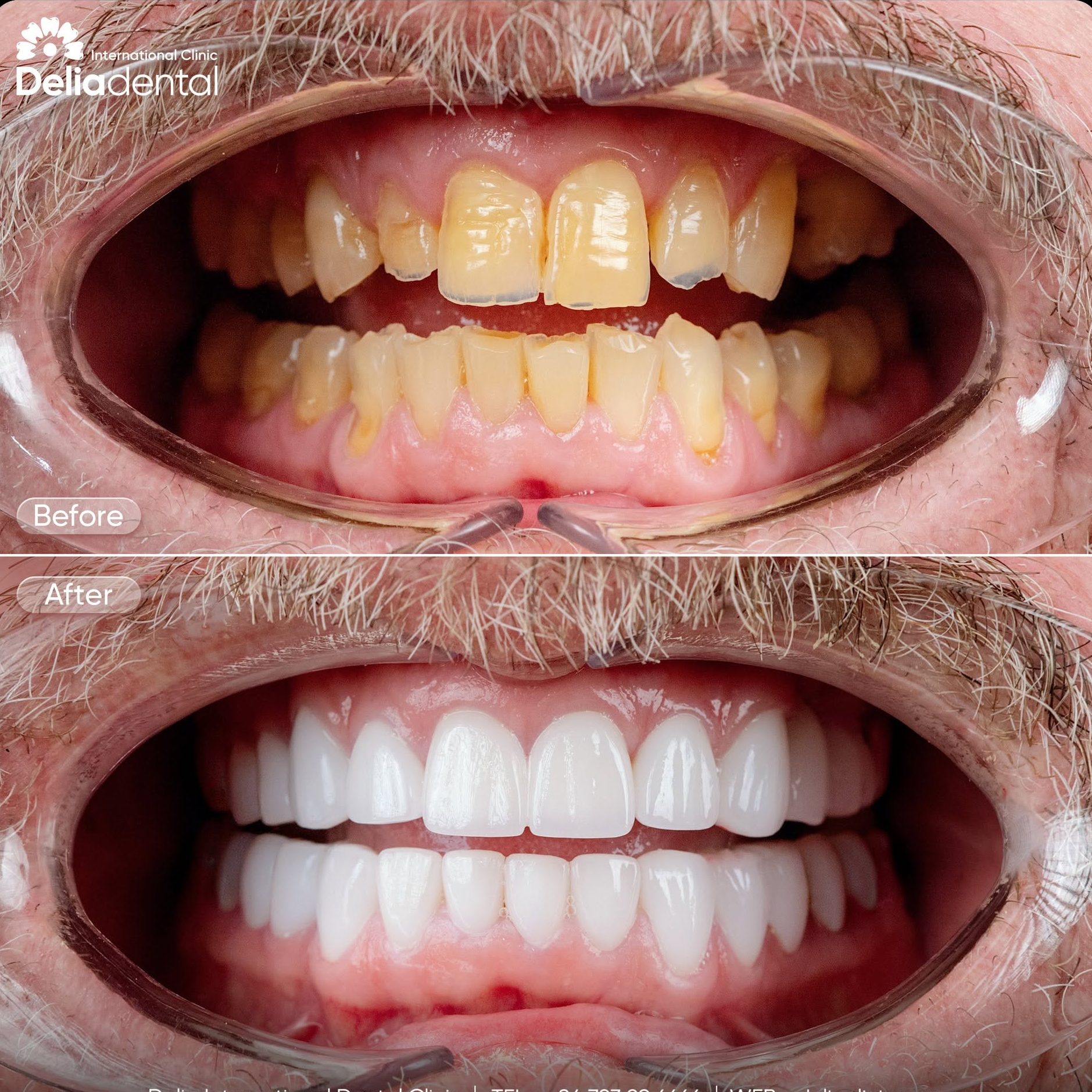 Dental care in Vietnam at Delia Dental Clinic 