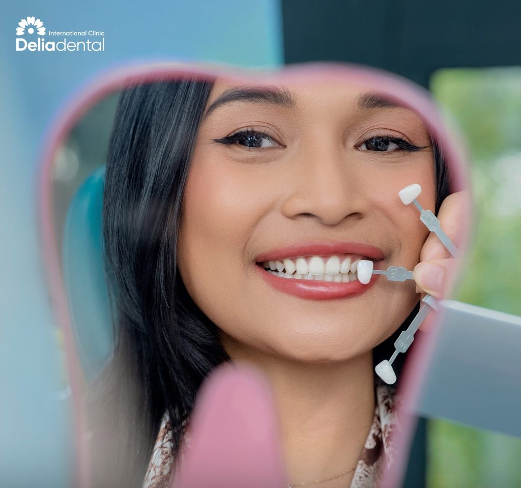 Compare veneer shade after the procedure