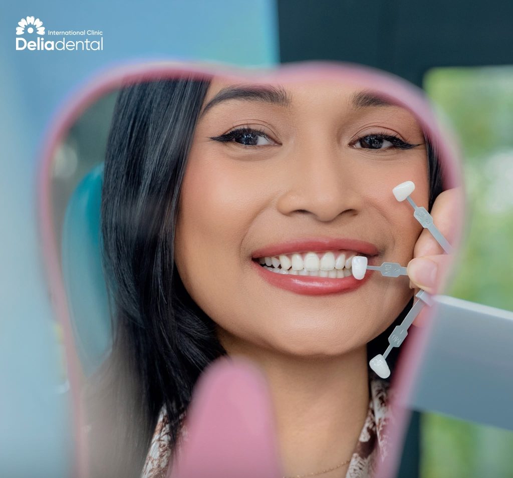 Compare veneer shade after the procedure