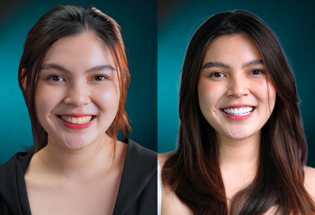Hannah before and after with E.max dental crown