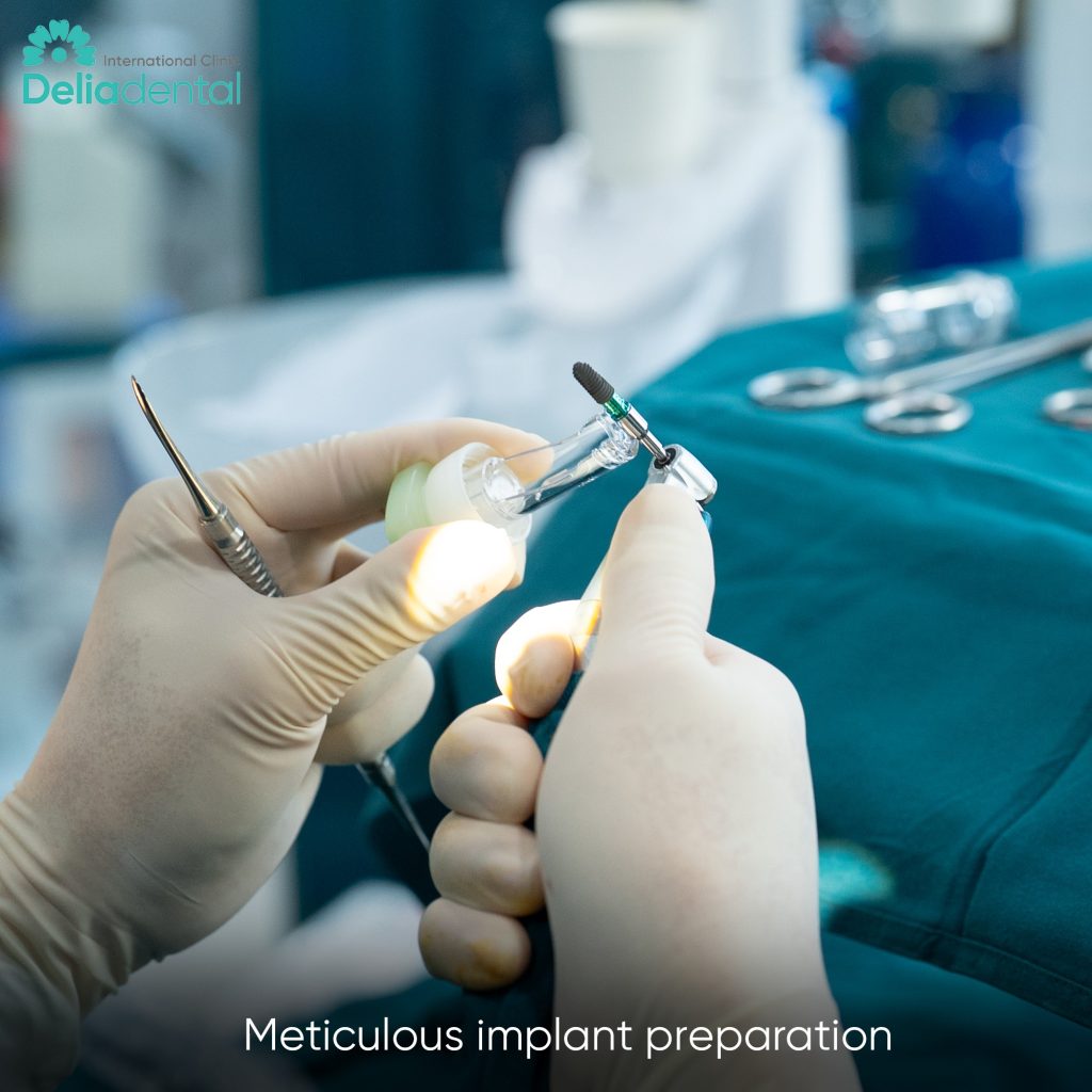 What Are Straumann Dental Implants and Are They Worth It in Vietnam?