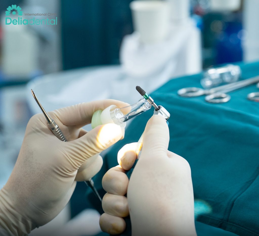 What Are Straumann Dental Implants and Are They Worth It in Vietnam?