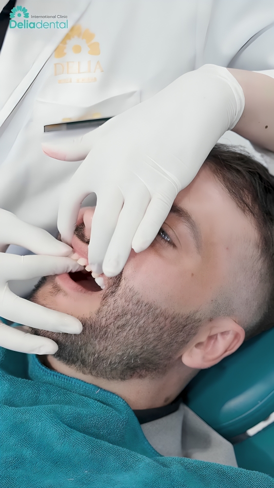 Zirnonia Crowns is being place on the old teeth