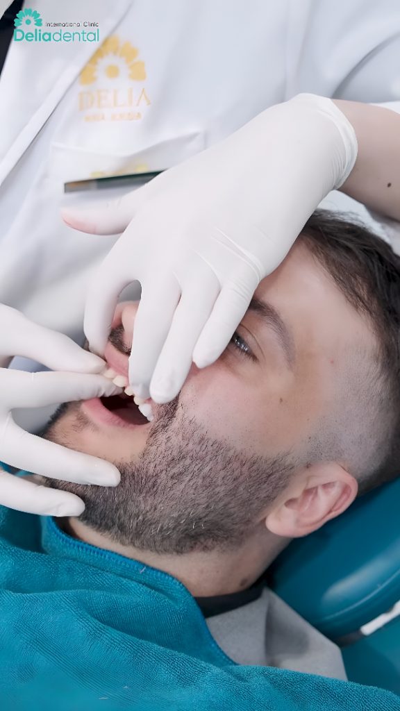 Zirconia Crowns in Vietnam: What Patients Need to Know