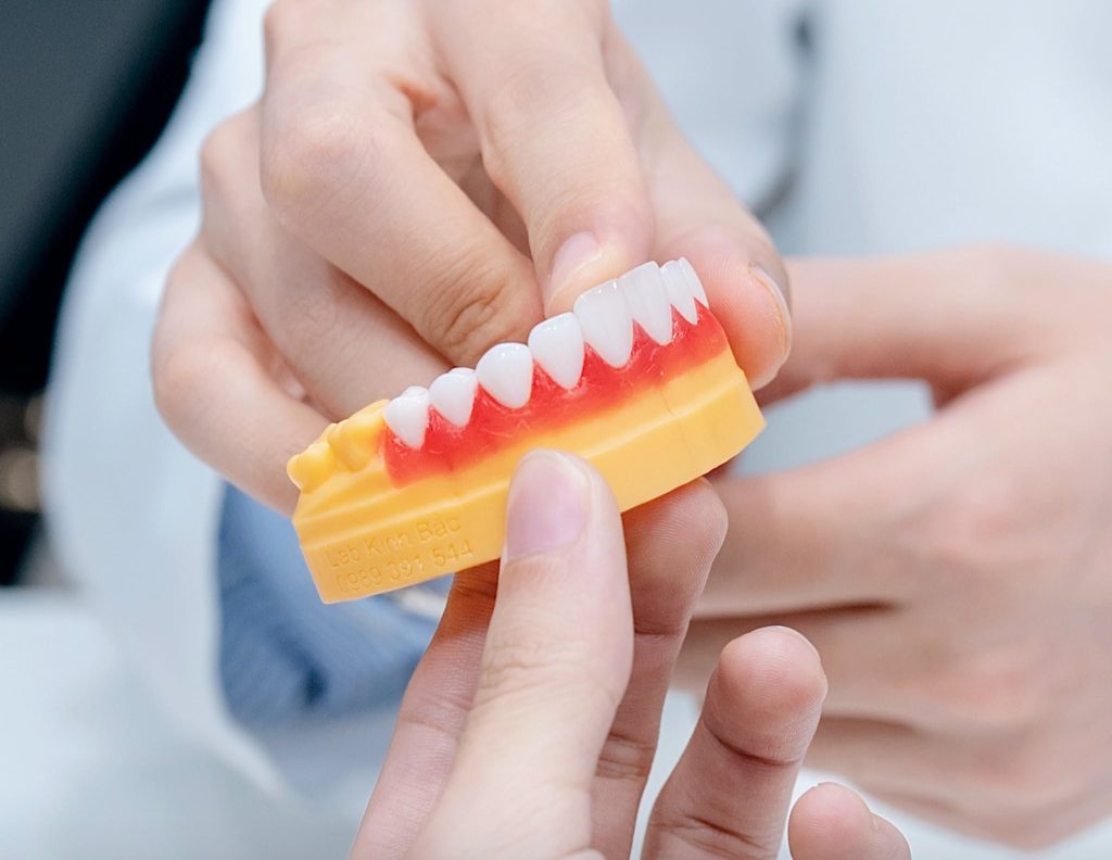 Dental Crown Cost in Vietnam: Zirconia & Emax Prices 