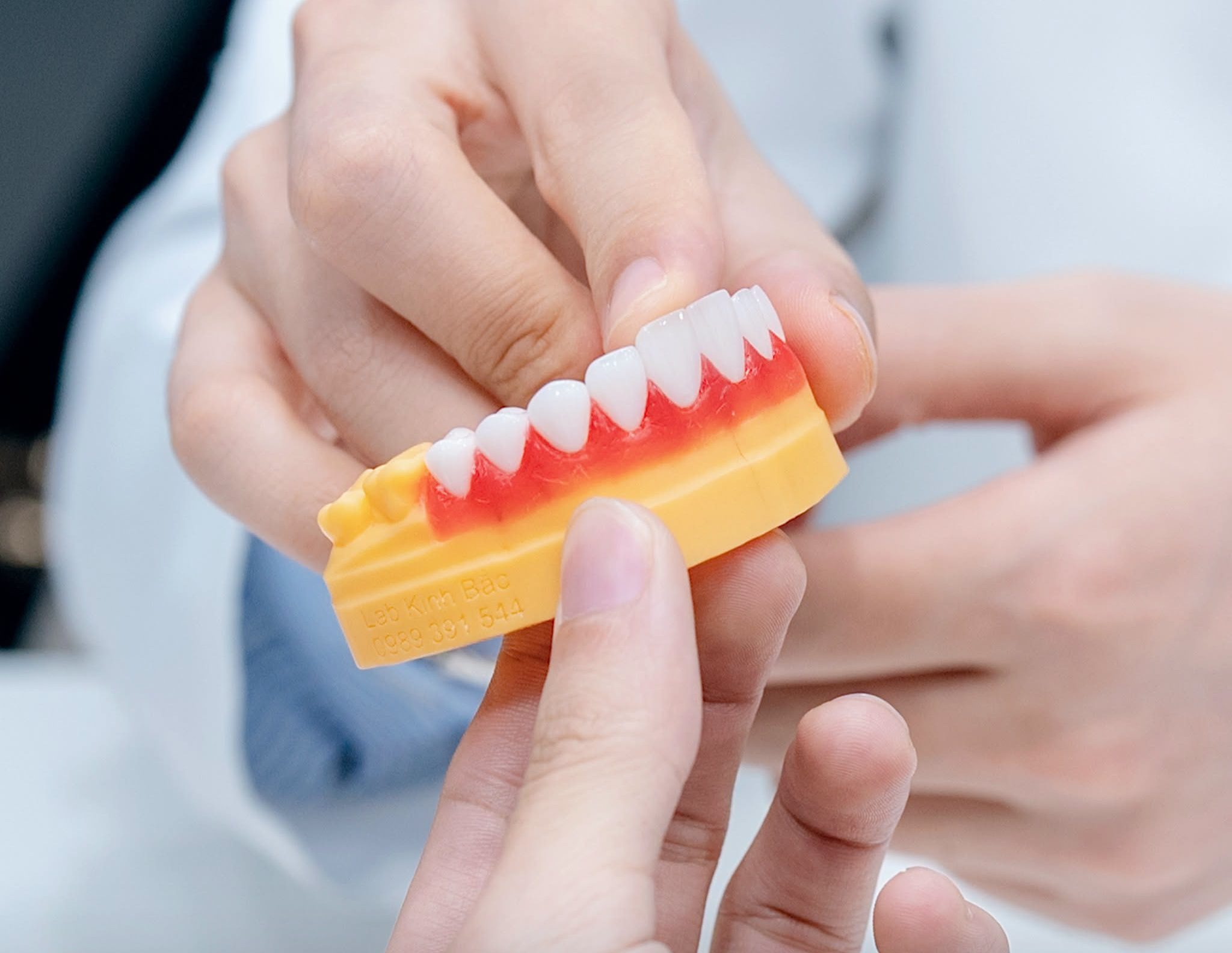 Dental Crown Cost in Vietnam: Zirconia & Emax Prices 