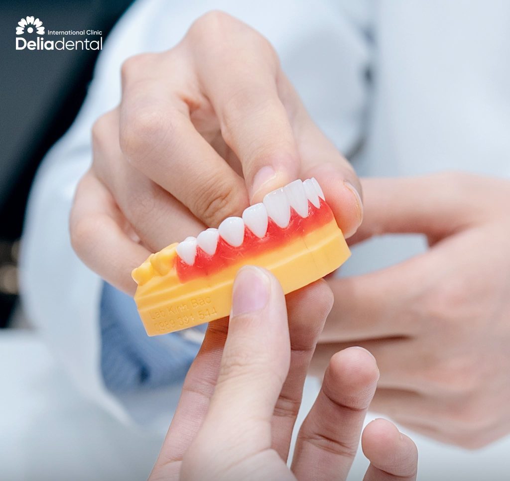 Dental crown in Delia Dental Clinic