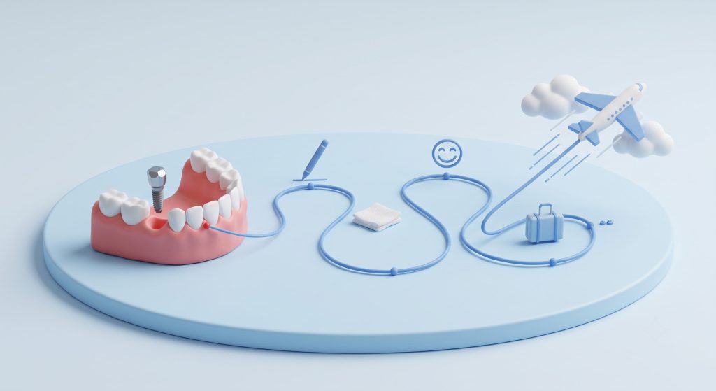 How Soon Can You Fly After Dental Implant Surgery?
