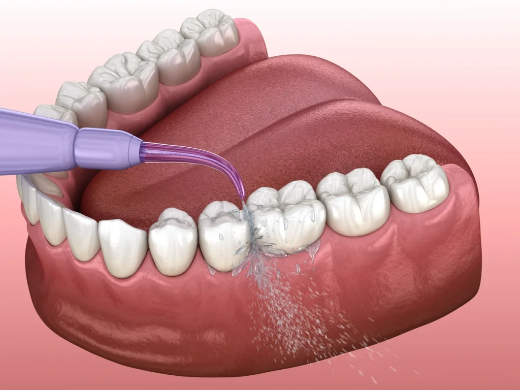 Remember to water floss daily