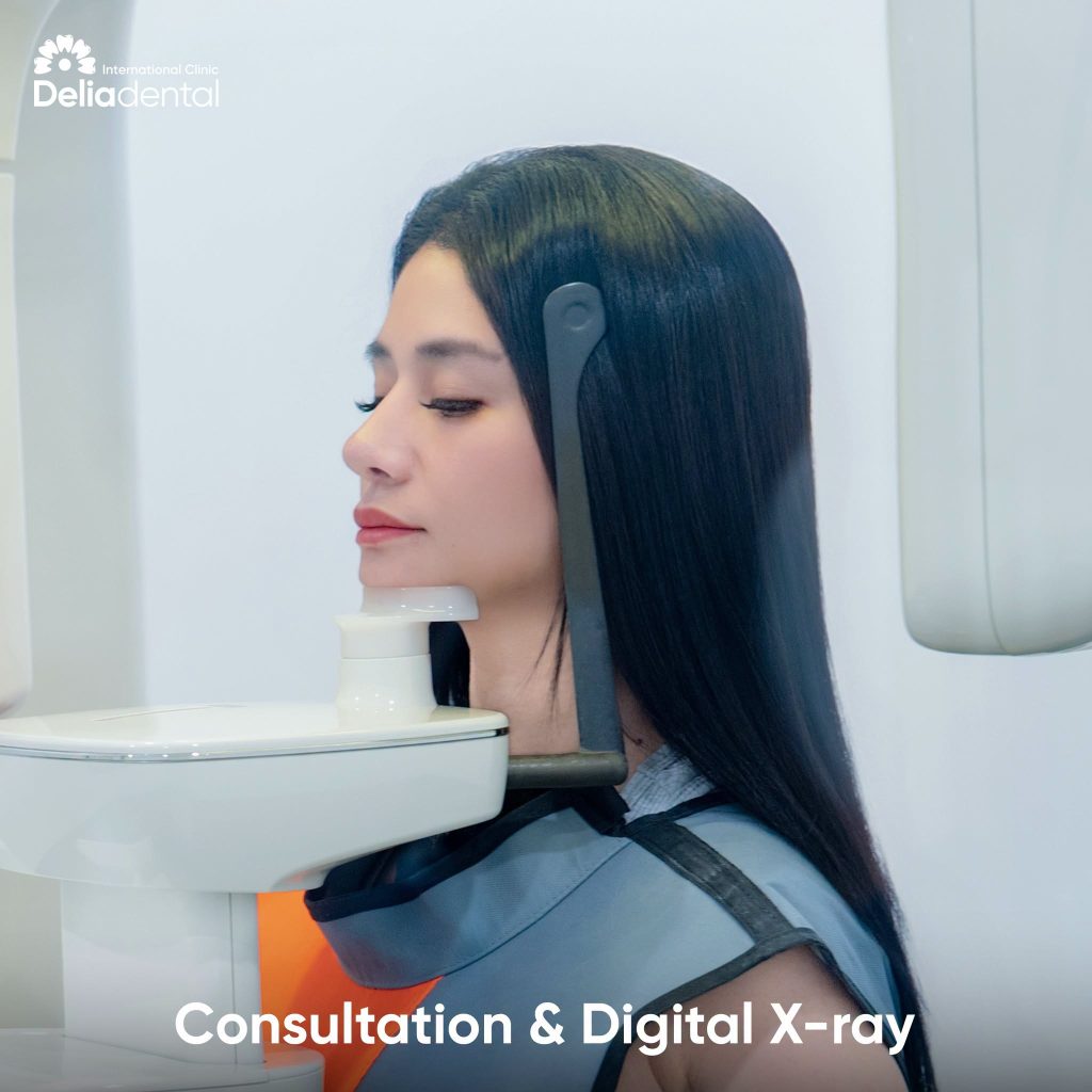 Consultation and Digital X-ray at Delia Dental Clinic
