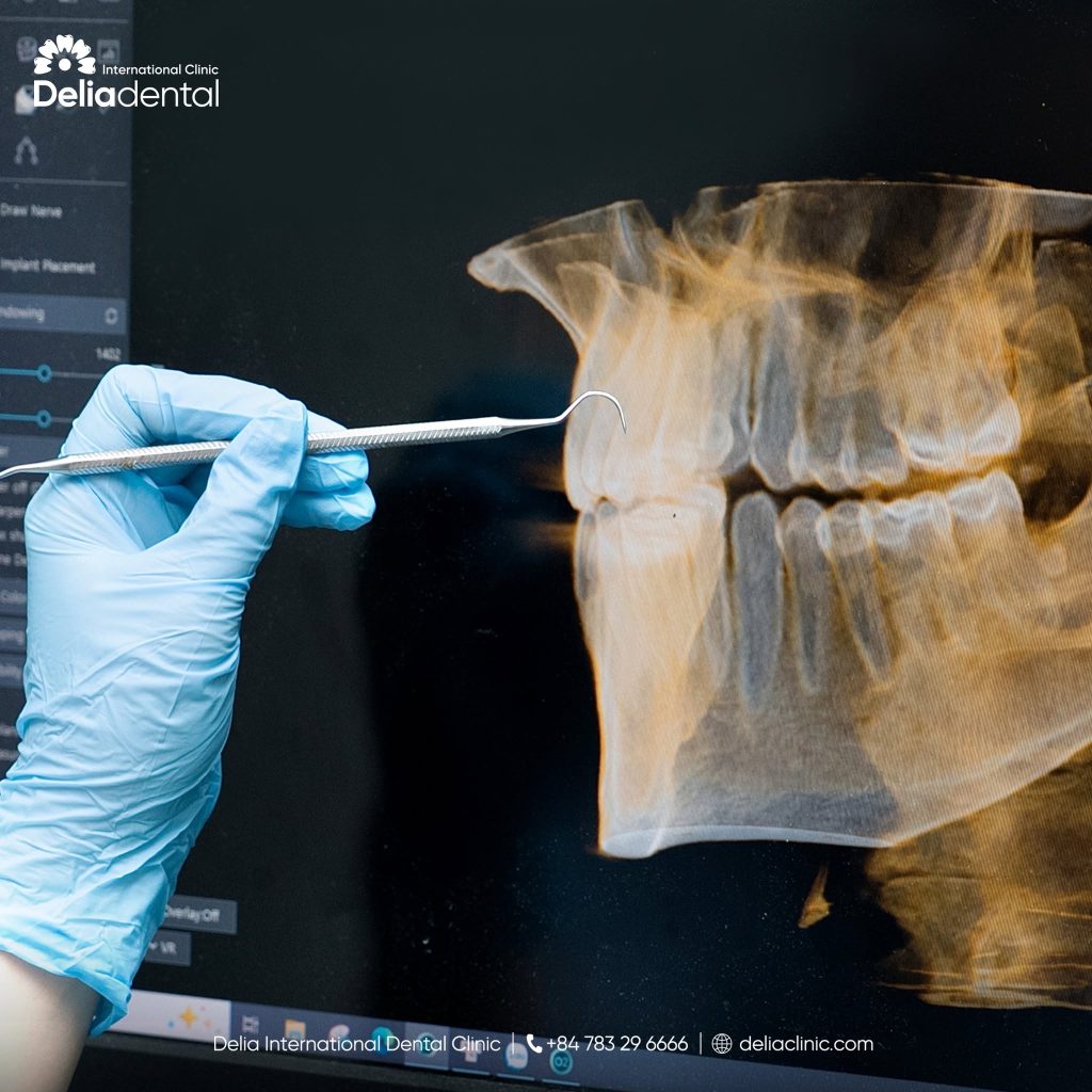 Detailed consultation with CBCT scan at Delia Dental Clinic