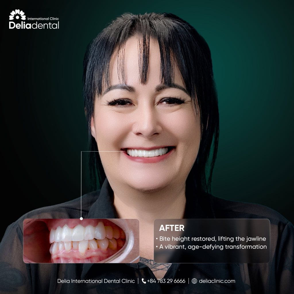 New Zealand patient's stunning smile makeover at Delia Dental Clinic
