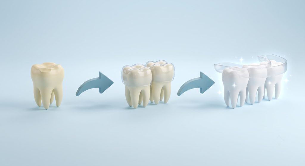 Worn, Yellow, Uneven Teeth: What Gets Treated First?