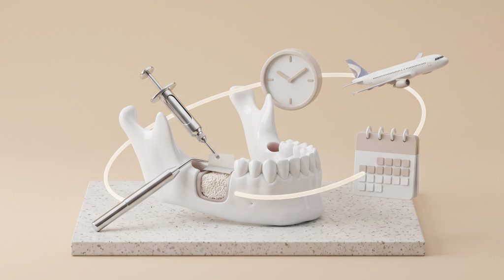 Dental Bone Grafting in Vietnam: Planning Your Return Flight