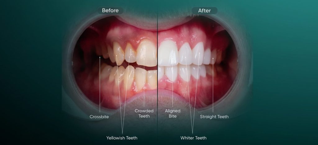 How to Read Dental Before and After Photos: What They Prove