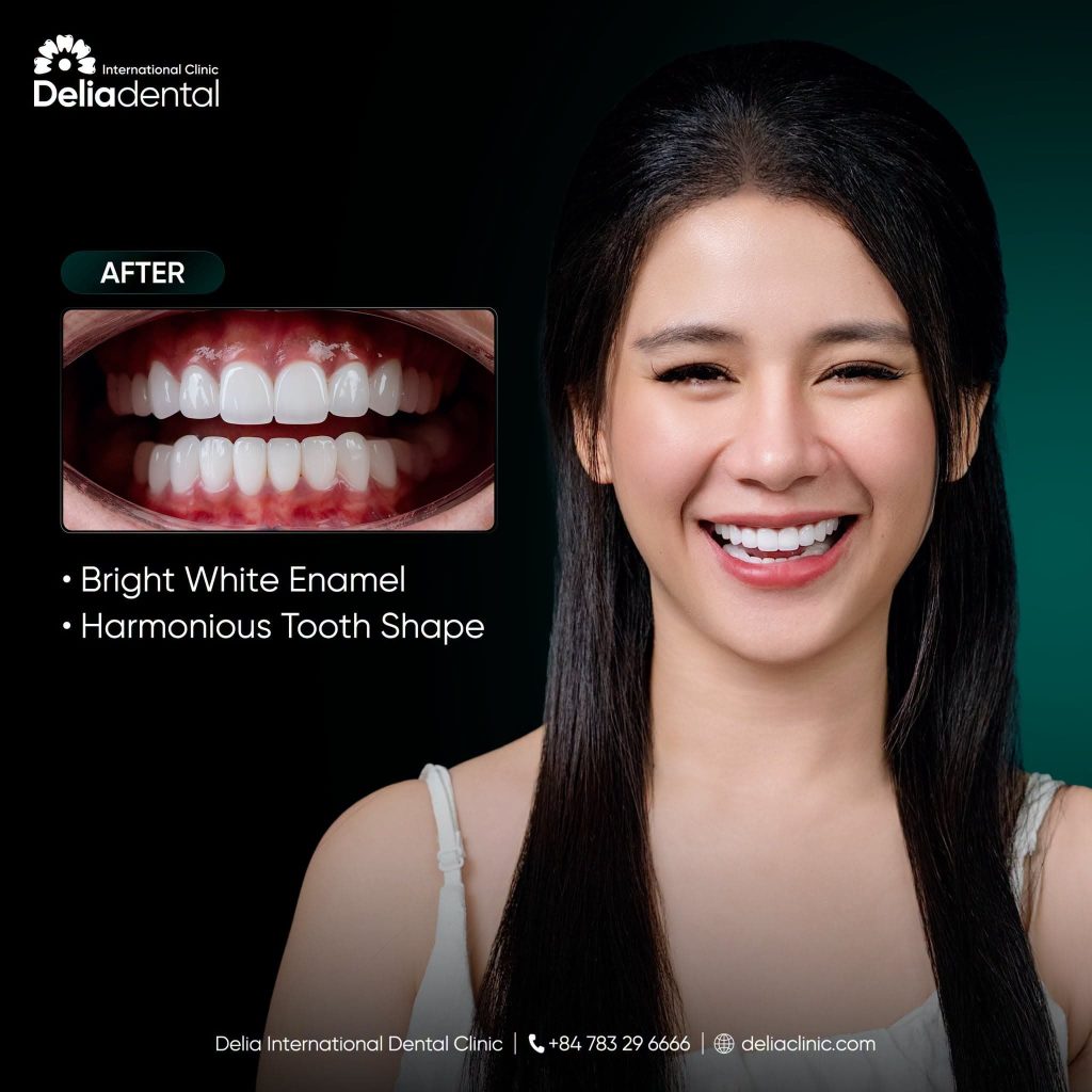 Multiple crowns placement at Delia Dental Clinic