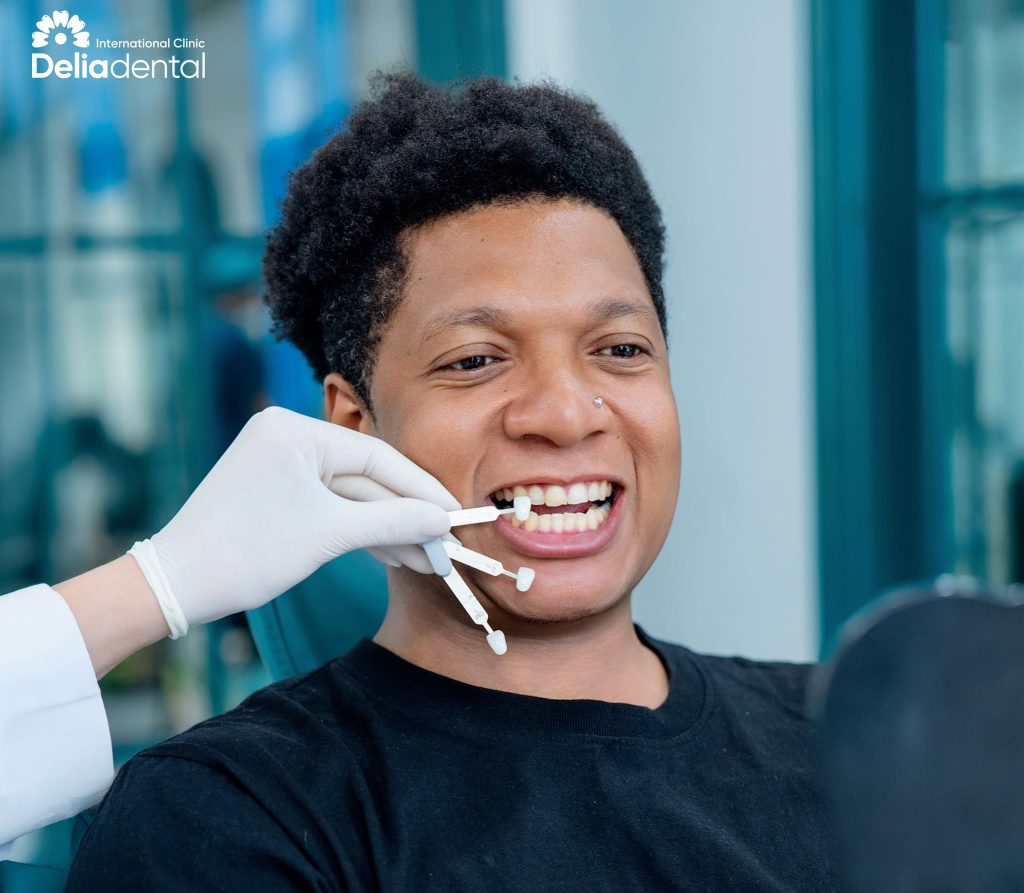 Veneer Try-In What Can Still Change Before Cementation