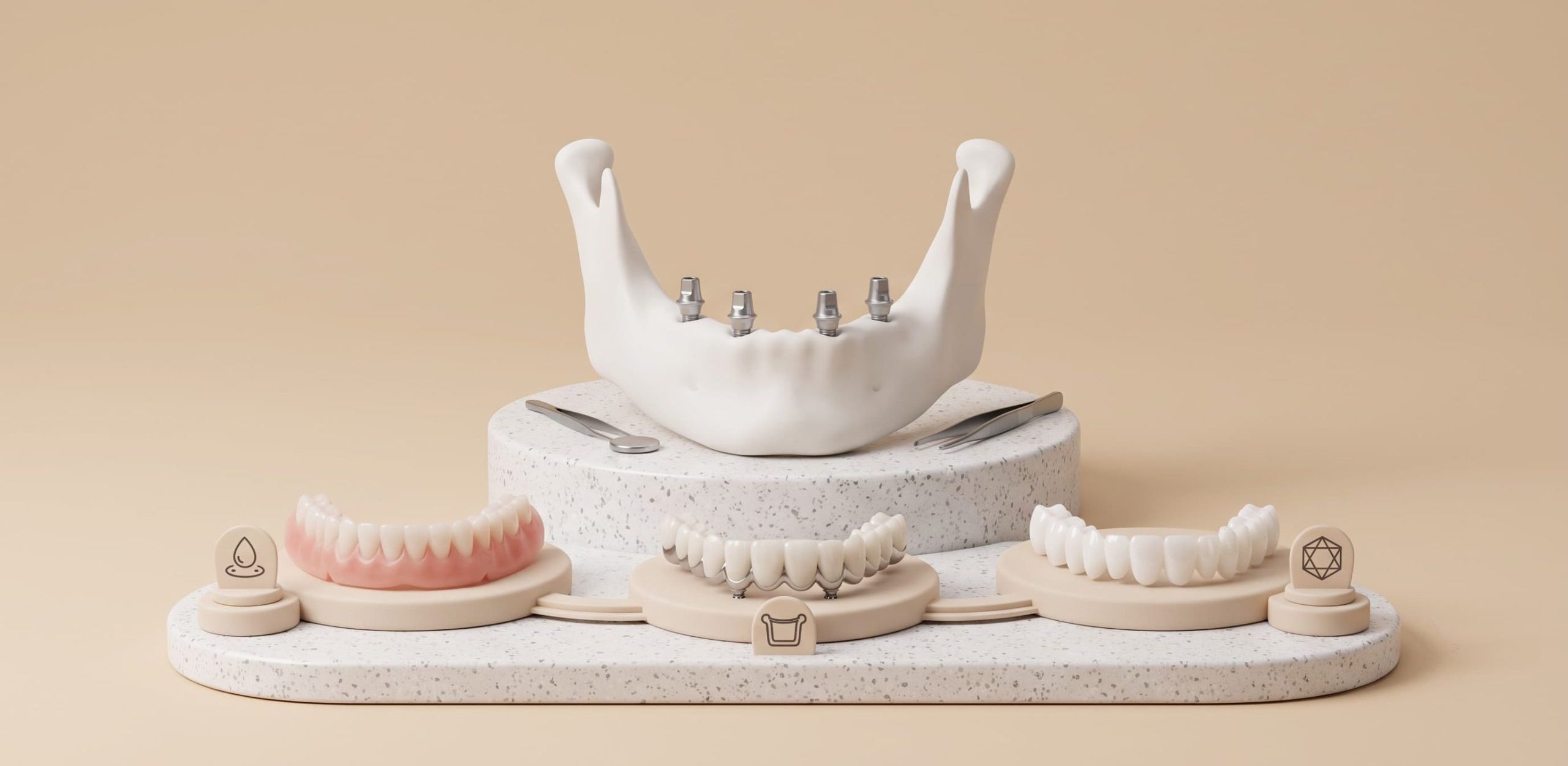 All-on-4 Final Teeth: Acrylic, Metal Ceramic or Zirconia?