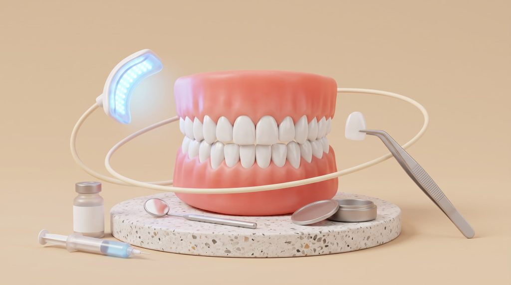 Teeth Whitening Before Veneers: Do You Need It First?